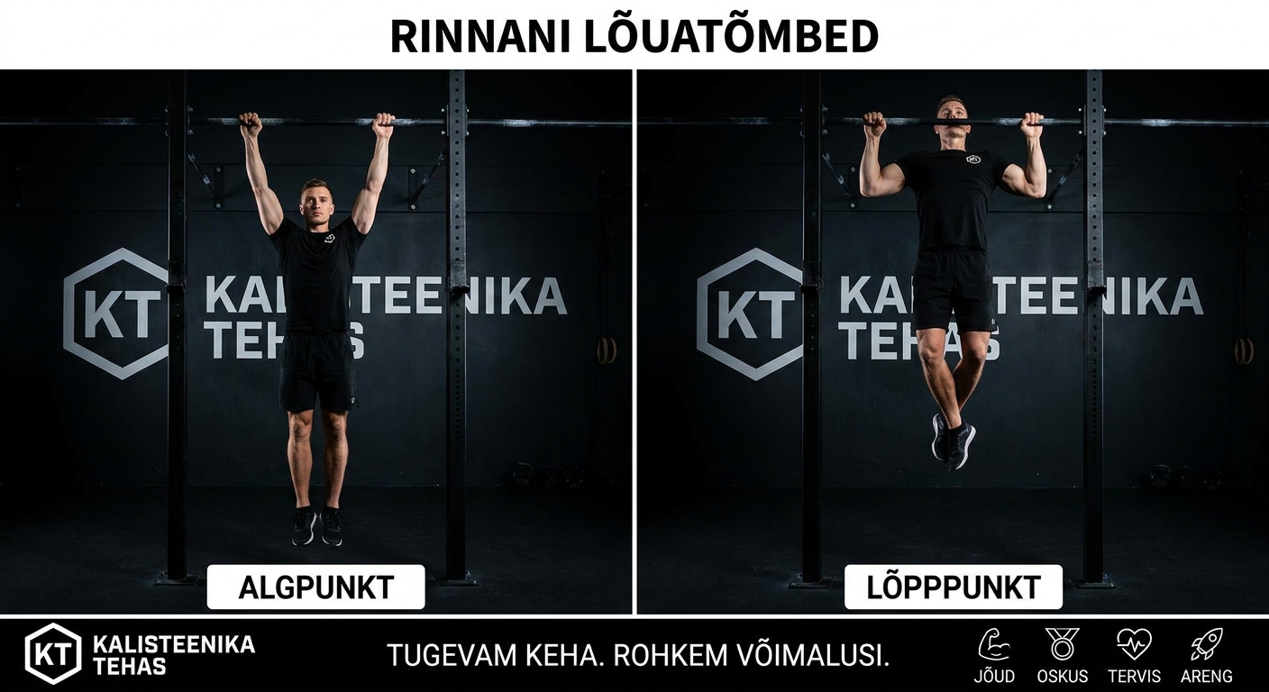 Rinnani lõuatõmme